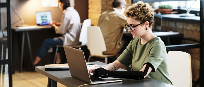 Junge Frau mit Armprothese arbeitet im Büro an einem Laptop.